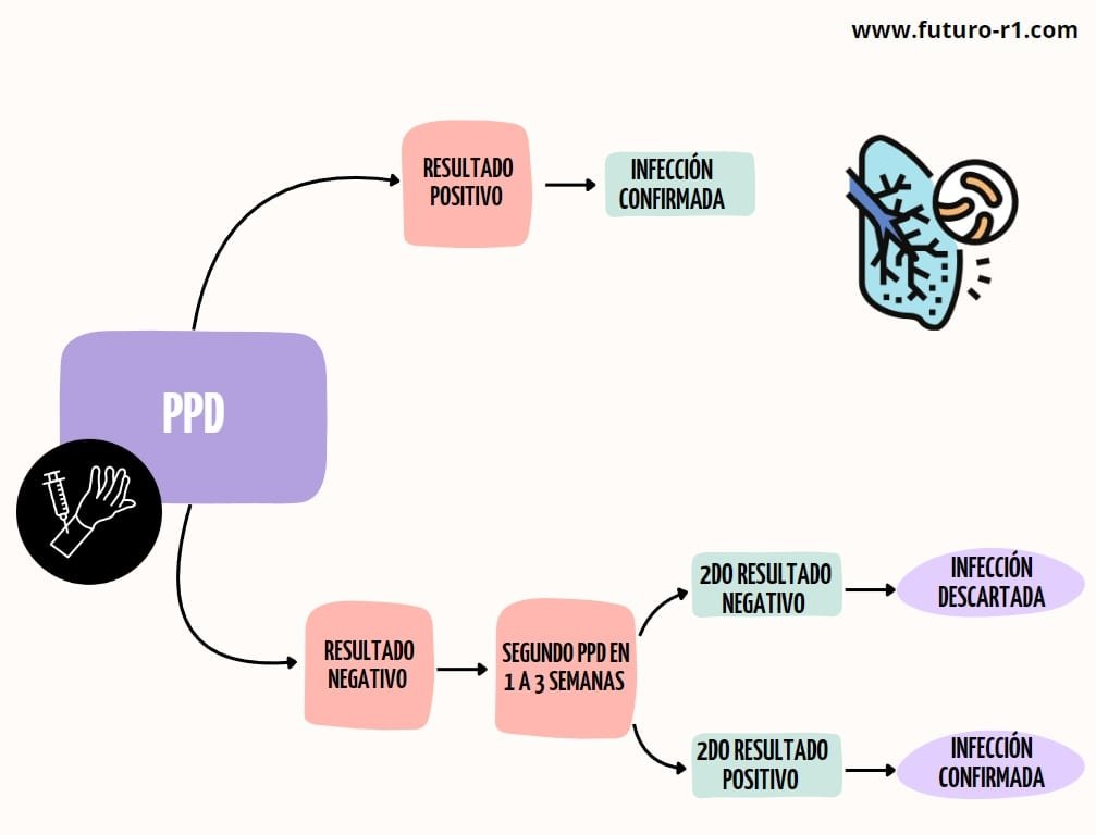 tuberculosis pulmonar